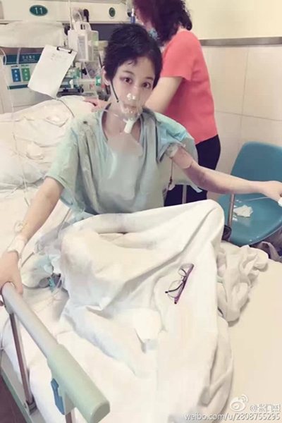 天长美女演员徐婷病危,求助所有好心人